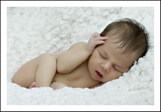 red-blotches-on-back-of-babys-head-netmums